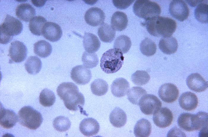 Αποκωδικοποιήθηκε το DNA του Plasmodium vivax που προκαλεί ελονοσία